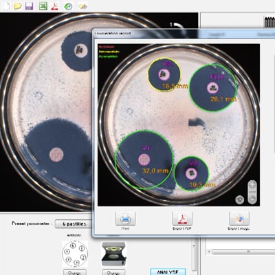 Interpret Petri dishes (SIR) with Scan