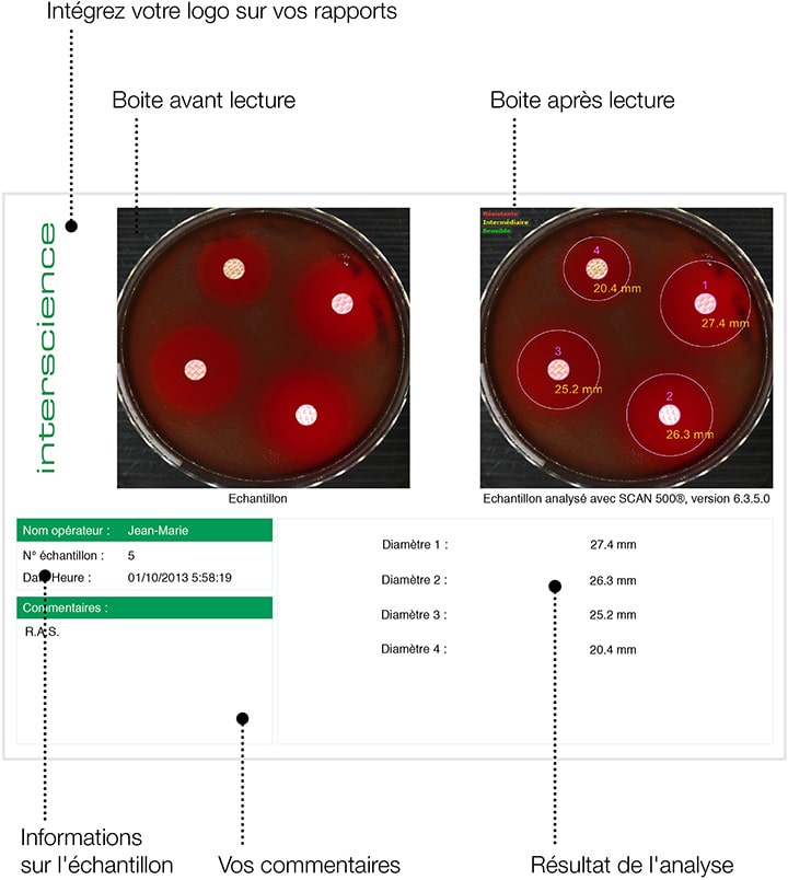 Scan 1200 Zone d'inhibition Rapport FR