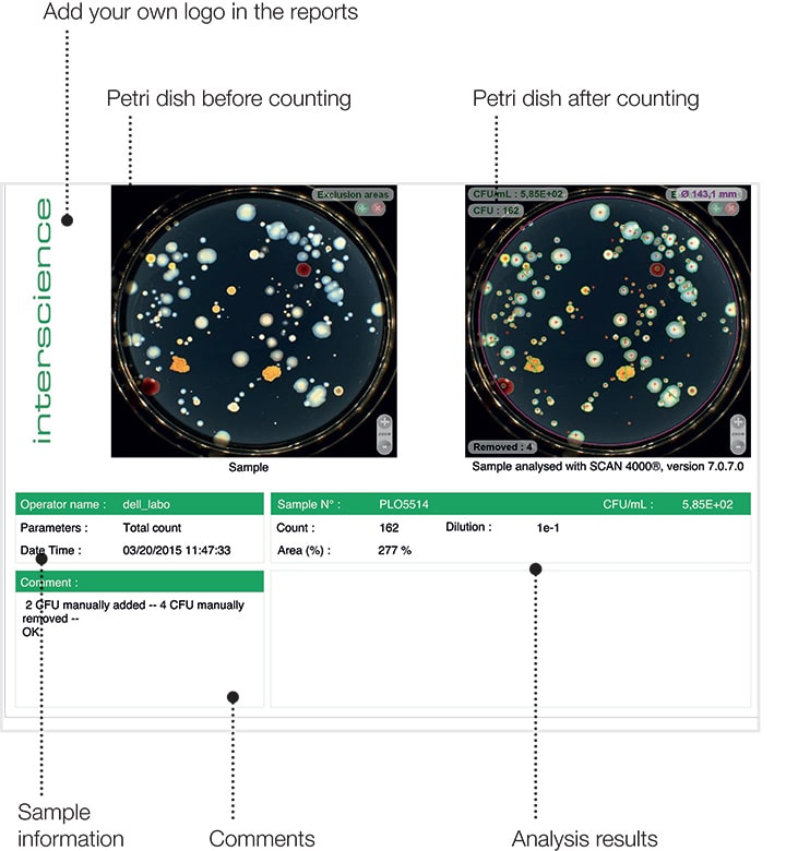 Scan 4000 - Ultra-HD colony counter