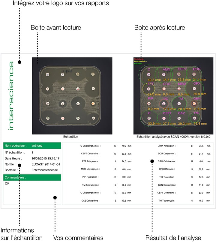 Scan 4000 Zone d'inhibition Rapport FR