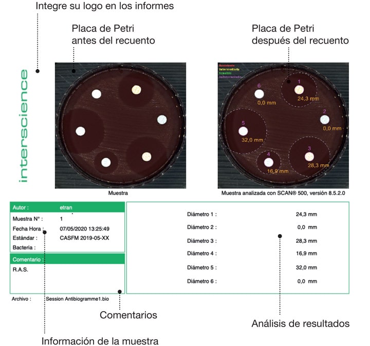 Scan 500 1200 Zone d'inhibition Rapport ES