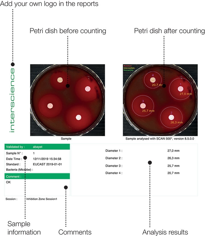 Scan 1200 Zone d'inhibition Rapport EN