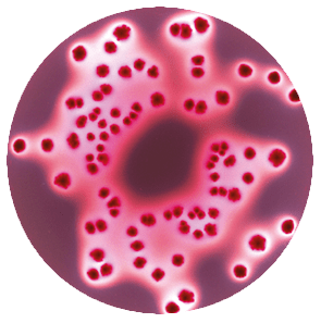 Diferentes concentraciones con la técnica de siembra en espiral