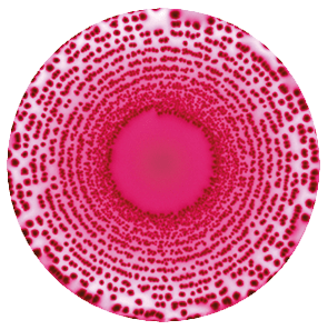 Diferentes concentraciones con la técnica de siembra en espiral