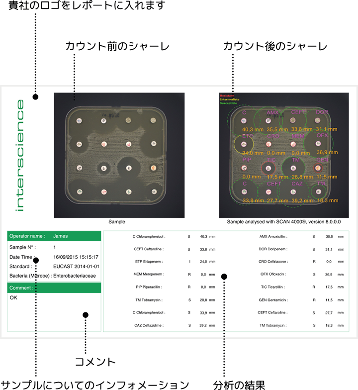 <span lang='fr'>Scan 4000 Lecteur de zones d'inhibition - Impression des résultats</span>