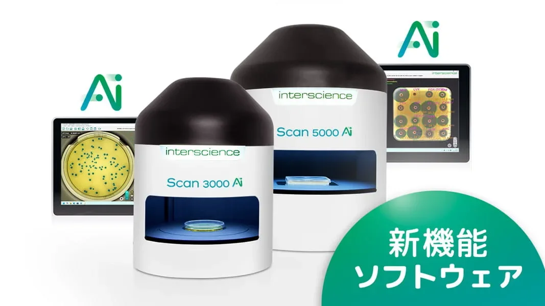 Scan Ai 次の新機能？