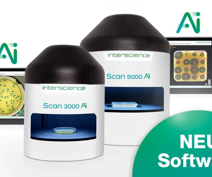 Was gibt es neues vom Scan Ai?