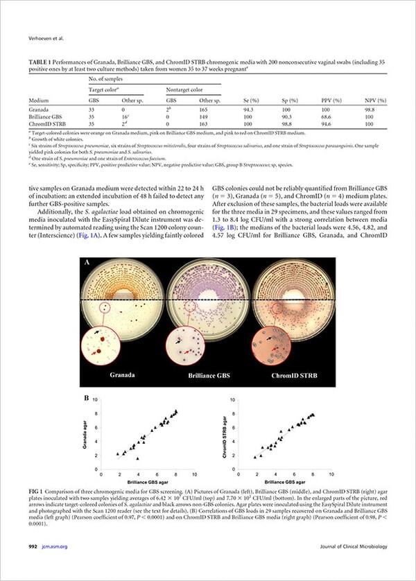 Evaluation of the New Brilliance GBS Chromogenic Medium for Screening of Streptococcus agalactiae Vaginal Colonization in Pregnant Women