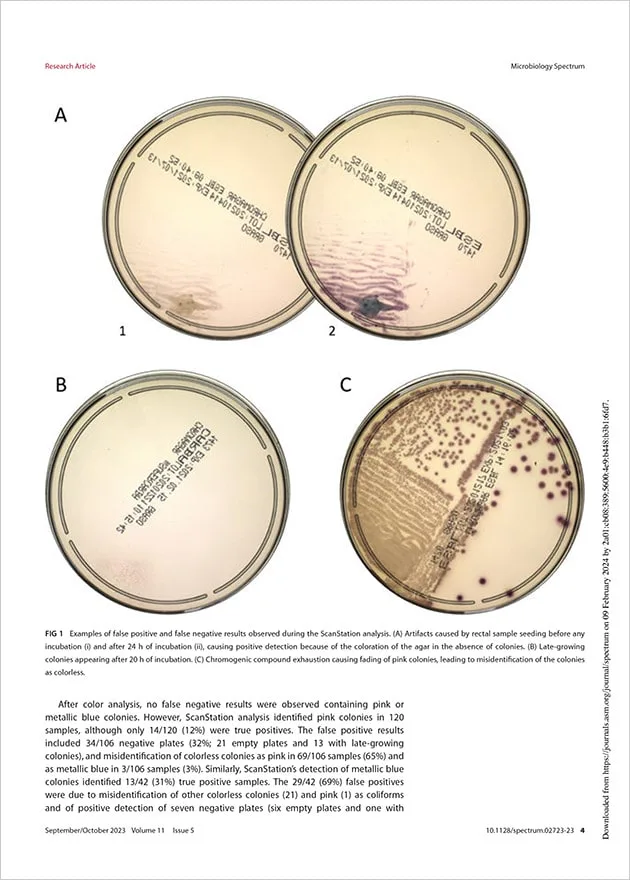 Rapid and automated screening of carbapenemase- and ESBL-producing Gram-negative bacteria from rectal swabs using chromogenic agar media and the ScanStation device